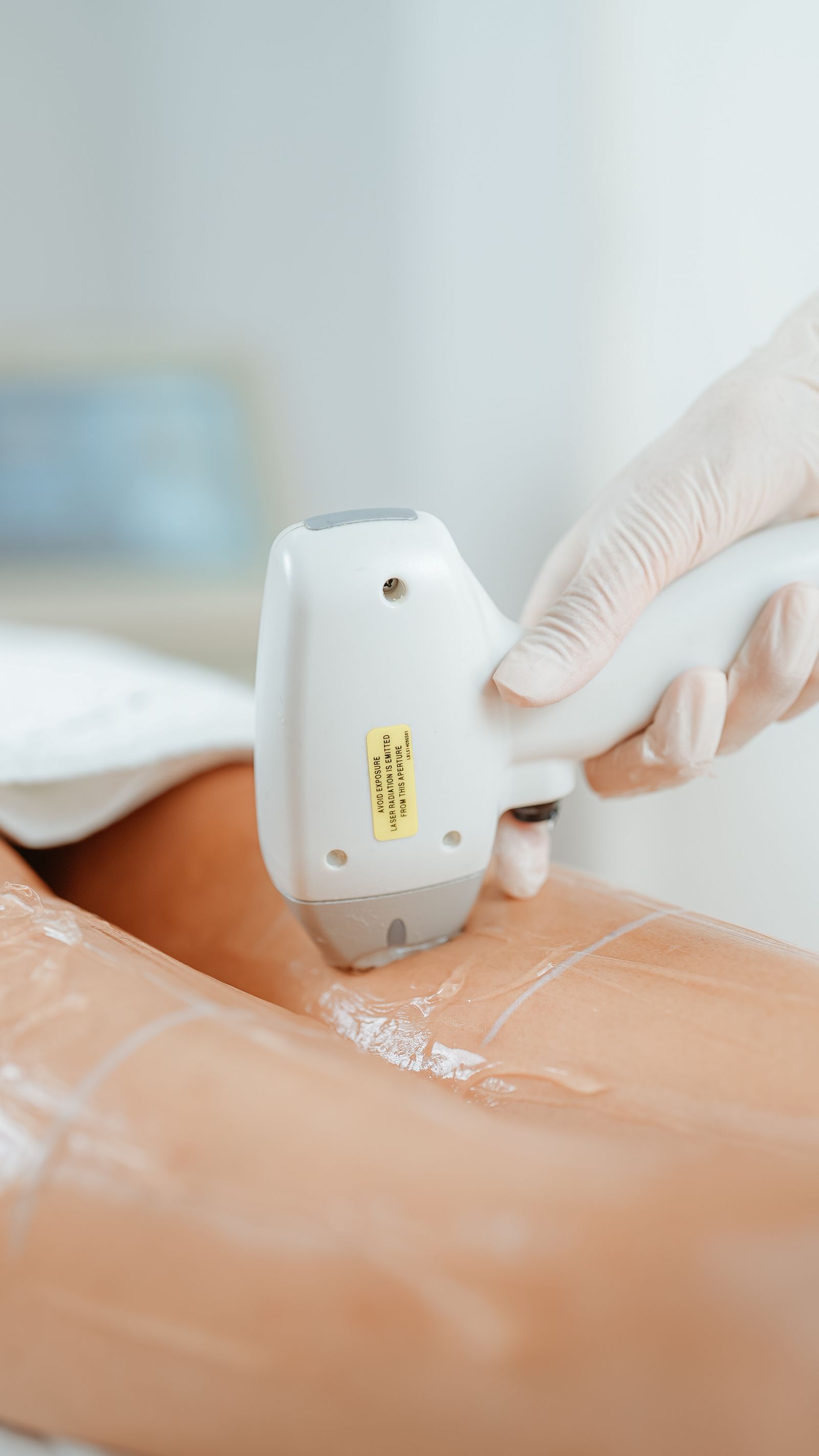 A laser hair-removal handpiece treating skin, laser-safety aperture label visible